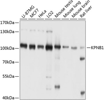 KPNB1 Antibody