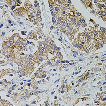 TRPA1 Antibody