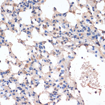 CD163 Antibody