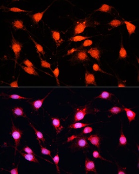 METTL3 Antibody