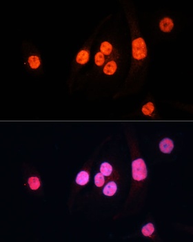 METTL3 Antibody