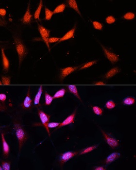 METTL3 Antibody
