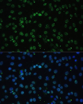 DDX39B Antibody