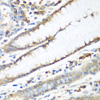 CAD Antibody