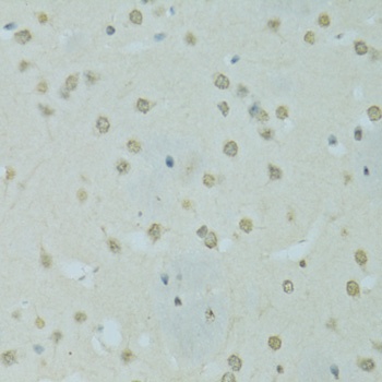 SAFB Antibody