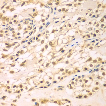 TBL1XR1 Antibody