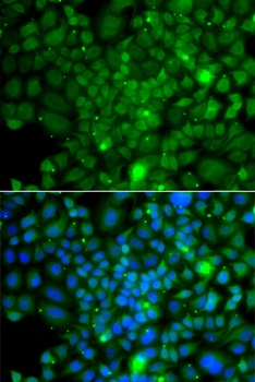 RRAGA Antibody
