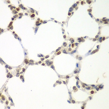 VRK1 Antibody