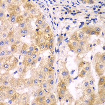 SULT2B1 Antibody