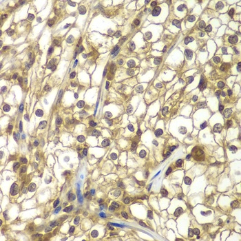 SULT2B1 Antibody