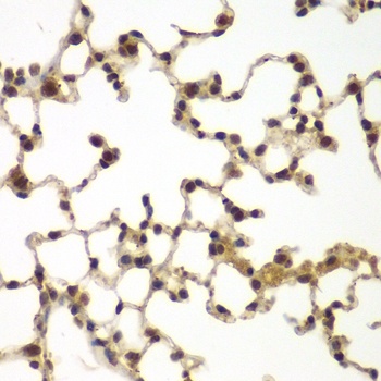 SULT2B1 Antibody