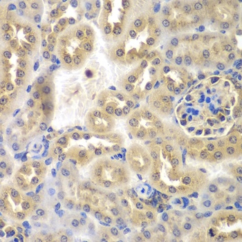 SULT2B1 Antibody