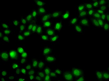SULT2B1 Antibody