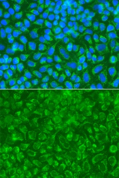 STRN Antibody