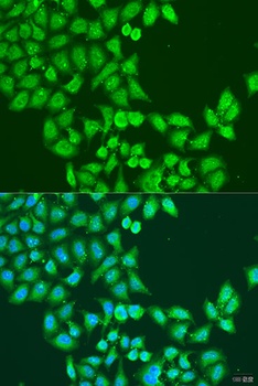 STAT5A Antibody