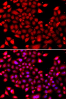 RARG Antibody