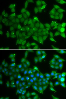 ANXA11 Antibody