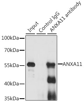 ANXA11 Antibody