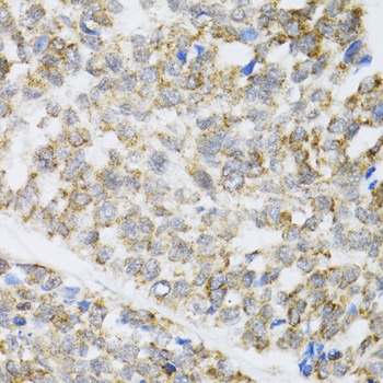 ZAK Antibody