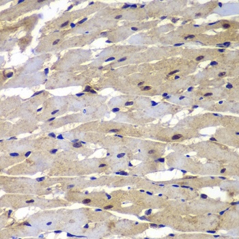 PSMB8 Antibody