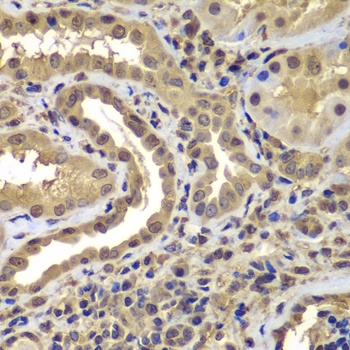 PSMB8 Antibody