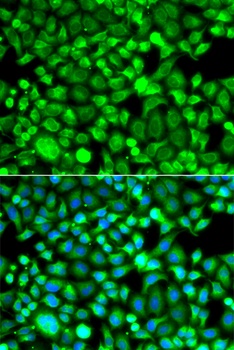 PSMB8 Antibody