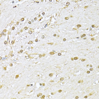 KU70 Antibody