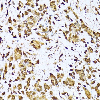 KU70 Antibody