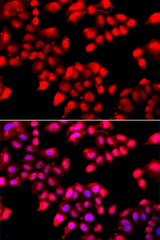 KU70 Antibody