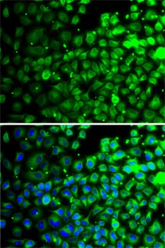 TXNDC5 Antibody