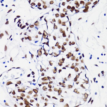 Acetyl-Histone H4-K8 pAb