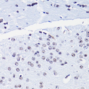 Acetyl-Histone H4-K8 pAb