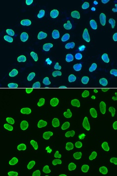 Acetyl-Histone H4-K8 pAb