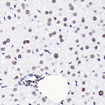 Acetyl-Histone H4-K8 pAb