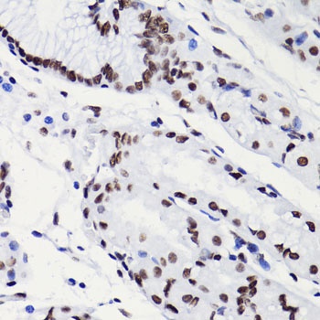 Acetyl-Histone H3-K18 pAb