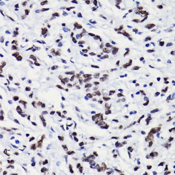 Acetyl-Histone H3-K18 pAb