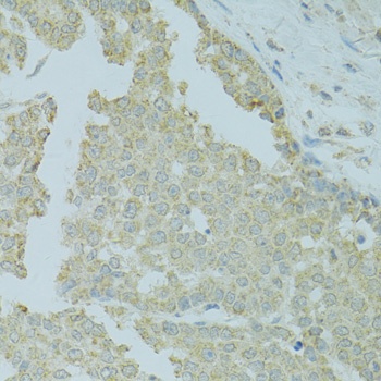 MTFP1 Antibody