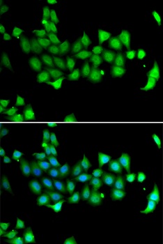 HSPA14 Antibody