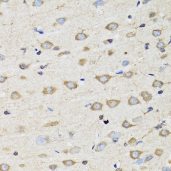 CLIC4 Antibody