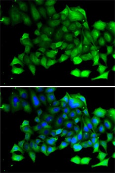 CLIC4 Antibody