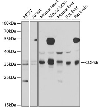 COPS6 Antibody