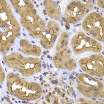 FASTK Antibody