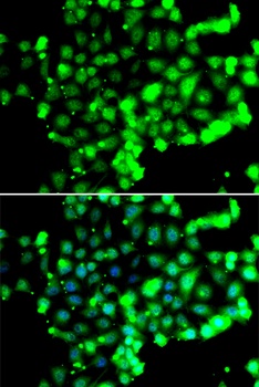FASTK Antibody