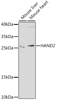 HAND2 Antibody