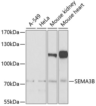 SEMA3B Antibody