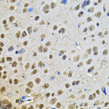 PPID Antibody