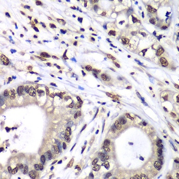 HNRNPM Antibody