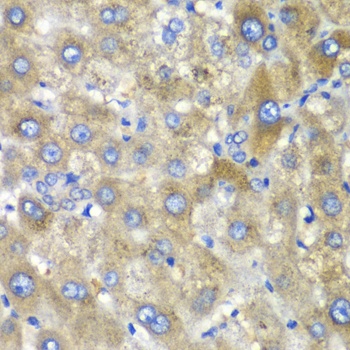 TLK2 Antibody