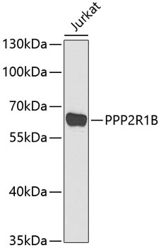 PPP2R1B Antibody