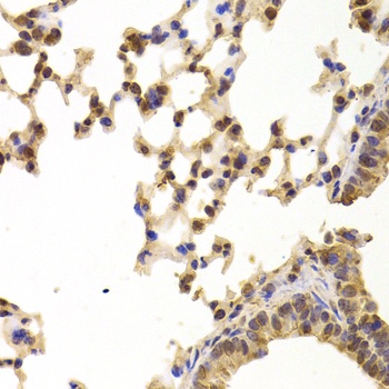 PPP2R1B Antibody